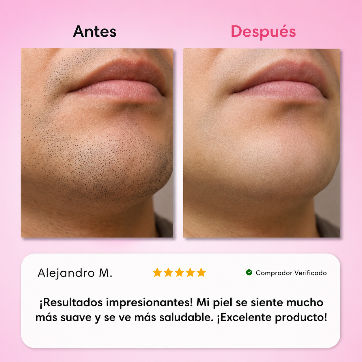 BERINOR Smooth™ Sistema de Depilación Facial 3 Pasos