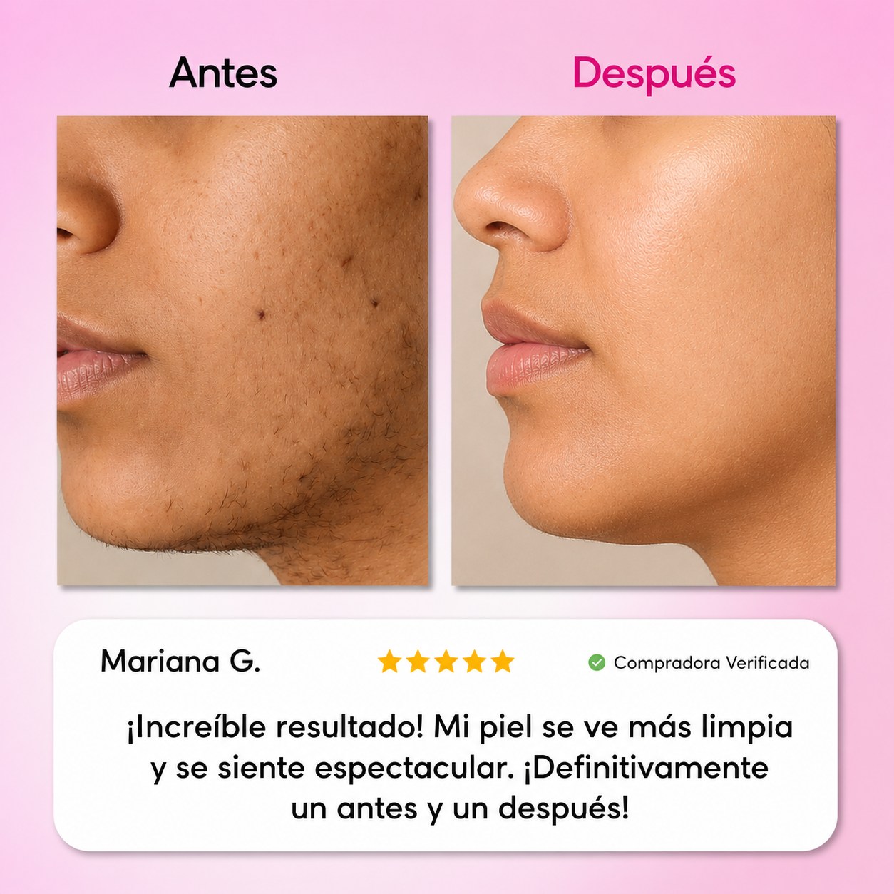 BERINOR Smooth™ Sistema de Depilación Facial 3 Pasos