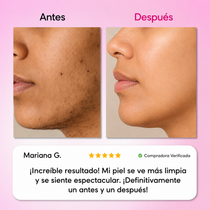 BERINOR Smooth™ Sistema de Depilación Facial 3 Pasos
