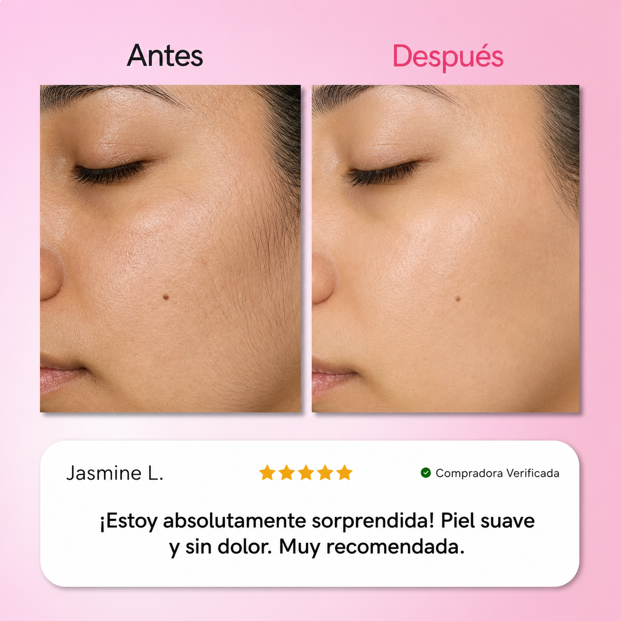 BERINOR Smooth™ Sistema de Depilación Facial 3 Pasos