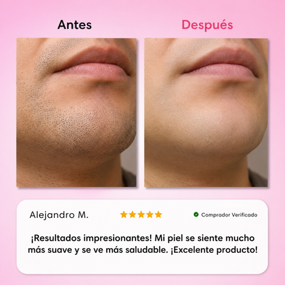 BERINOR Smooth™ Sistema de Depilación Facial 3 Pasos
